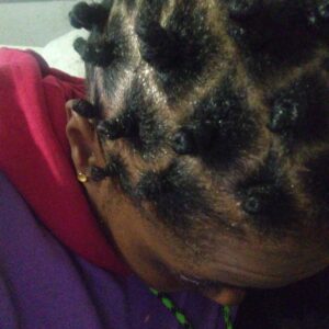 Scalp Care